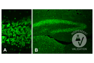 Immunohistochemistry validation image for anti-Histone H4 (HISTH4) (acLys12) antibody (ABIN6254899)
