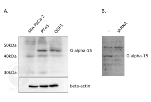 Immunoblot in TBST using milk 5% as blocking agent; see protocol for details. A. Lysate from pancreatic cancer cell lines was loaded as indicated. B. Lysate from PT45 cells, untreated in lane 1 and treated with shRNA specific for GNA15 in lane 2.