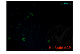 Immunofluorescence validation image for anti-Amyloid beta (A4) Precursor Protein (APP) (AA 666-670) antibody (ABIN197433)