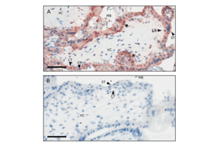 Immunohistochemistry validation image for anti-Keyhole Limpet Hemocyanin (KLH) antibody (ABIN401183) (KLH 抗体)