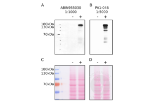 Western Blotting validation image for anti-Synaptic Ras GTPase Activating Protein 1 (SYNGAP1) (AA 1169-1183), (Internal Region) antibody (ABIN955030) (SYNGAP1 抗体  (Internal Region))