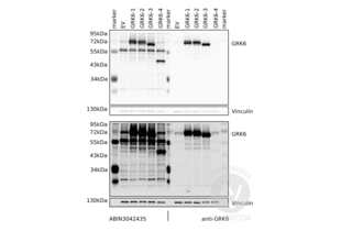 Western Blotting validation image for anti-G Protein-Coupled Receptor Kinase 6 (GRK6) (C-Term) antibody (ABIN3042435) (GRK6 抗体  (C-Term))