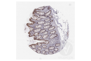 HAVCR1 Antikörper  (C-Term)