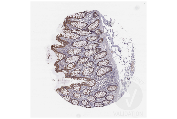 HAVCR1 Antikörper  (C-Term)