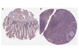 Staining of human colon (A.) and tonsil (B.) sections in a tissue microarray with ABIN3042564. See the protocol for detailed information.