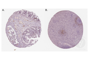 Immunohistochemistry validation image for anti-Mucosal Vascular Addressin Cell Adhesion Molecule 1 (MADCAM1) (Middle Region) antibody (ABIN3044076) (MADCAM1 抗体  (Middle Region))
