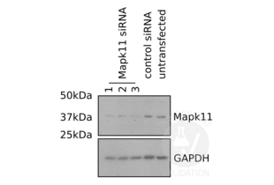 Primary mouse microglia were transfected with Mapk11 siRNA and Mapk11 was revealed using ABIN2798348 as described in the protocol section (lanes 1, 2, and 3). Lysates from cells transfected with scrambled siRNA (lane 4) and untransfected cells (lane 5) served as negative controls.