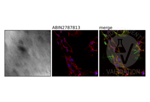 IHC staining of NRD1 using ABIN2787813 (red, middle) on isolated equine retinal Müller glial cells. Counterstain with DAPI (blue) and an anti-Vimentin antibody (green). 
