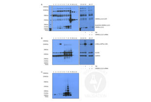 A. Western blot analysis using ABIN2774396 of ORMDL1, ORMDL2 and ORMDL3 expression in total lysates from Jurkat cells (1), Jurkat cells stably expressing ORMDL3-HA (2),  Flp-In T-Rex HEK293 cells with fusion SPT without and with tetracycline (3 and 4),  293T cells with pcDNA3.1 (5), HEK cells with NubG-HA tagged ORMDL1 (6), 2 (7) or 3 (8), transiently transfected with pCMVAC-ORMDL1-GFP (9), and purified ORMDL1-GFP (10), ORMDL2-GFP (11) and ORMDL3-GFP (12).  ORMDLs siRNA expression decreases endogenous ORMDLs protein in uninduced cells and in Flp-In T-Rex HEK293 cells harboring tet inducible SPT as revealed by western blot using ABIN2774396 on lysates from Flp-In T-Rex HEK293 cells harboring Tet inducible SPT without Tet (13, 14) and with Tet (15) and all without siRNAs compared to cell lysates subsequently to siRNA ORMDL1, 2, and 3 knockdown without (16) or with Tet induction (17). B. Western blot analysis of the same lysates using anti-human LCB1 and GAPDH antibodies and C. an anti-HA antibody. 