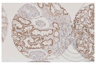 Figure 1: Human kidney stained with AQP2 (brown).