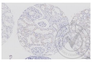 Immunohistochemistry validation image for anti-Aquaporin 2 (Collecting Duct) (AQP2) (AA 171-271) antibody (ABIN707576) (AQP2 抗体  (AA 171-271))