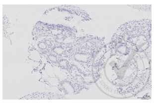 Immunohistochemistry validation image for anti-Aquaporin 2 (Collecting Duct) (AQP2) (AA 171-271) antibody (ABIN707576)