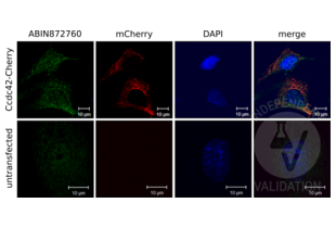 Immunocytochemistry detection of NIH/3T3 cells expressing mCherry-labeled Ccdc42 (Ccdc42-Cherry) using ABIN872760 (green) or an mCherry antibody (red). Untransfected NIH/3T3 cells served as negative control. The pictures on the right show the red and green channels merged with DAPI counterstain (blue). 