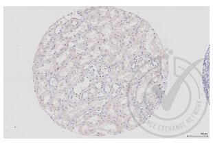Figure 1: Human kidney tissue stained with anti-DVL1 (brown) and counterstained with hematoxylin. 