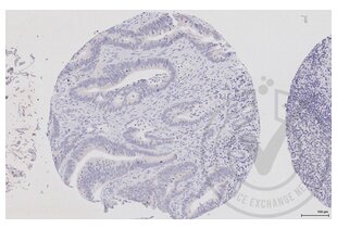 Figure 2: Human colon tissue stained with anti-DVL1 (brown) and counterstained with hematoxylin. 