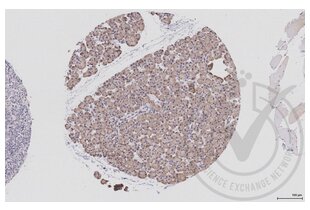 Figure 1: Human pancreas tissue stained with anti-EIF4E (brown) and counterstained with hematoxylin. 