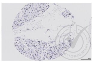 Figure 3: Human pancreas tissue stained with isotype control antibody (brown) and counterstained with hematoxylin. 