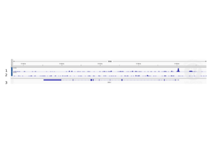 Cleavage Under Targets and Release Using Nuclease validation image for anti-Forkhead Box O1 (FOXO1) (AA 165-270) antibody (ABIN1387620) (FOXO1 抗体  (AA 165-270))