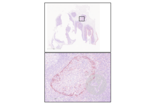 IIHC staining of human tonsil with anti-CD25 antibody ABIN670371 (1:250) and counterstain with hematoxylin.