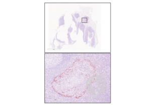 IHC staining of human tonsil with anti-CD25 antibody ABIN670371 (1:500) and counterstain with hematoxylin.