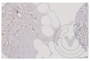 Immunohistochemistry validation image for anti-Mitogen-Activated Protein Kinase Kinase 5 (MAP2K5) (AA 251-350) antibody (ABIN754183) (MAP2K5 抗体  (AA 251-350))