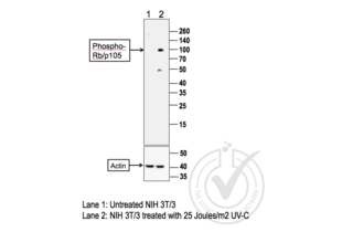 Figure 1: Western Blot for RB1 pSer780. Grey arrowhead indicates the expected molecular weight of ~105 kDa.