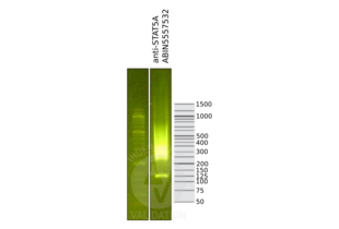 Library profiles comparing fragment size distributions on an E-Gel EX 2% agarose gel (Thermo Fisher). Fragments obtained from CUT&RUN using STAT5A ABIN5557532 (right) after library preparation, compared to the E-Gel Sizing DNA Ladder (Thermo Fisher) (left).