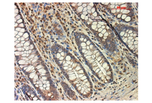 Immunohistochemistry validation image for anti-TGF beta Receptor 1 (AA 301-400) antibody (ABIN671256)