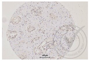 Immunohistochemistry validation image for anti-Tight Junction Protein 1 (TJP1) (AA 1551-1702) antibody (ABIN675024)