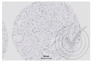 Immunohistochemistry validation image for anti-Tight Junction Protein 1 (TJP1) (AA 1551-1702) antibody (ABIN675024)