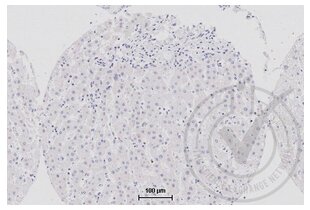 Immunohistochemistry validation image for anti-Tumor Necrosis Factor (Ligand) Superfamily, Member 9 (TNFSF9) (AA 101-200) antibody (ABIN705056)