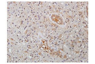 Immunohistochemistry validation image for anti-Wingless-Type MMTV Integration Site Family Member 2 (WNT2) (AA 221-320) antibody (ABIN762896)