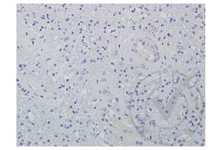 Immunohistochemistry validation image for anti-Wingless-Type MMTV Integration Site Family Member 2 (WNT2) (AA 221-320) antibody (ABIN762896)