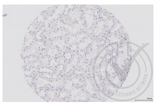 Immunohistochemistry validation image for anti-Wingless-Type MMTV Integration Site Family, Member 2B (WNT2B) (AA 301-391) antibody (ABIN675728)