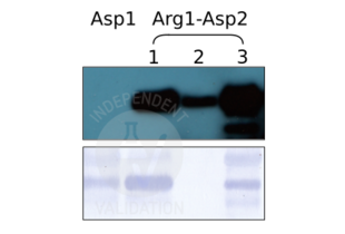 Detection of detect a bacterially expressed recombinant protein with ABIN4368250, either with the N-terminal amino acid sequences Arg1-Asp2 in three independent preparations (lanes 1, 2, and 3; upper panel) or an N-terminal Asp1. ABIN4368250 only recognizes the protein with the amino-terminal sequence Arg-Asp. For each preparation, 20µg of total protein were loaded onto the SDS-PAGE gel. The lower panel shows a Coomassie stain loading control.