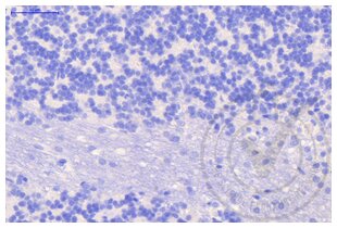 Figure 3: Cerebellum stained with isotype control (brown) and counterstained in blue. 