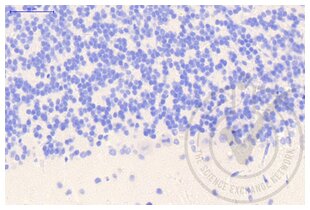Figure 1: Cerebellum stained with secondary antibody only (brown) and counterstained in blue. 