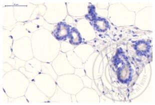 Immunohistochemistry validation image for anti-Clathrin (AA 4-171) antibody (ABIN968006) (Clathrin 抗体  (AA 4-171))