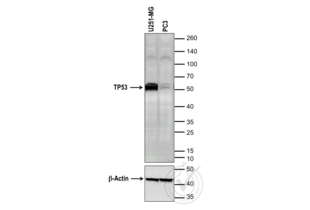 Western Blotting validation image for anti-Tumor Protein P53 (TP53) (full length) antibody (ABIN967416)