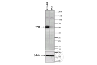 Western Blotting validation image for anti-Tumor Protein P53 (TP53) (full length) antibody (ABIN967416) (p53 抗体  (full length))