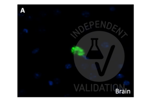 Staining of beta-amyloid positive cells in the adult mouse brain using ABIN2855011 at 40x magnification. 