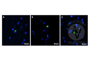 Immunohistochemistry validation image for anti-Amyloid beta (Abeta) (C-Term) antibody (ABIN5508784)