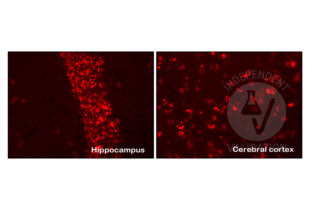 Immunohistochemistry validation image for anti-Amyloid beta (Abeta) (C-Term) antibody (ABIN5508784)