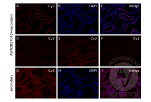 IF staining of prostate from inducible AR-lacZ mouse with ABIN2857043 shows robust staining for the AR at 1:100 dilution (A) and colocalization with nuclear DAPI staining (B, C). Staining at 1:250 (D) and 1:500 (E) dilutions is weaker with higher background. Staining at a dilution of 1:1000 (F) does not work. Non-specific signal in the secondary antibody-only control is both extracellular and nuclear. Exposure 5x of that used to image ABIN2857043 was used in G to capture the non-specific signal in the TRITC channel. H shows DAPI imaged at 100ms and I shows that the non-specific signal is both extracellular and nuclear, as shown by the partial colocalization of the non-specific signal with DAPI. 