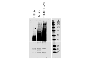 20µg total protein of cultured HeLa cells and human melanoma cell lines SKMEL28 and A375 were separated on an 4-20% polyacrylamid gel under denaturing conditions. Bands were revealed as described in the protocol sections with ABIN1440014 diluted 1:500.