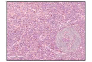 IHC staining of human tonsil with anti-CD84 antibody ABIN3187786 (1:100) and counterstain with hematoxylin.