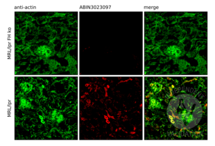 IF staining with ABIN3023097 of kidneys harvested from 14 week old MRL/lpr mice sufficient and deficient in factor H. Cryosections were fixed, stained and images acquired as described in the protocol.