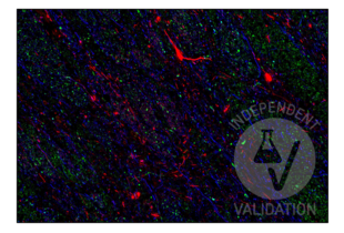 Multiplex Immunohistochemistry validation image for anti-Cortactin (CTTN) (N-Term) antibody (ABIN2854674) (Cortactin 抗体  (N-Term))