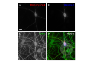 Hippocampal primary culture co-transfected with Kv2.1_Dendra and HomerDsRed (A, red fluorescence of Homer), stained with anti-Dendra2 ABIN361314 (B, revealed with A647-coupled secondary antibody) and anti-MAP2 antibody (C, revealed with A488-coupled secondary antibody). Merged images in (D), showing the labeling of anti-Dendra2 antibody (blue) that reveals the transfected cell identified by the fluorescence of HomerDsRed (red) but not the non-transfected cells (visible by the immunolabeling of MAP2, green). Scale bar: 10µm, 63x magnification.