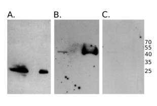HA-tagged fusion proteins were expressed in NIH/3T3 cells. Whole cell lysates were separated by SDS-PAGE and the tagged protein detected using anti HA-tag antibody ABIN2443910 diluted 1:600. Expected molecular mass of the fusion proteins were approximately 26kDa (A.) and 43kDa (B.) respectively. The left lane corresponds in both blots A. and B. to the pellet, the right to the supernatant after centrifugation. Exposition time for image capture on X-ray films: 1min (A.) and 30min (B.). For C., samples were prepared as for B. but the anti HA-tag antibody ABIN2443910 was diluted 1:1000. Exposure time: 15min.